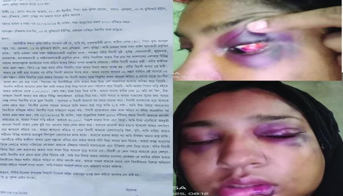 চৌদ্দগ্রামে যৌতুকের দাবিতে গৃহবধূকে নির্যাতনের অভিযোগ