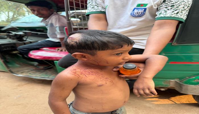 দেবিদ্বারে প্রতিবেশির উঠনে খেলতে যাওয়ায়   সাড়ে তিন বছরের শিশুকে কুপিয়ে ও পিটিয়ে আহত