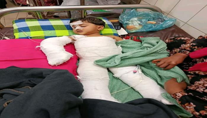 ব্রাহ্মণপাড়ায় গরম পানিতে   ঝলসে চার বছরের শিশুর মৃত্যু