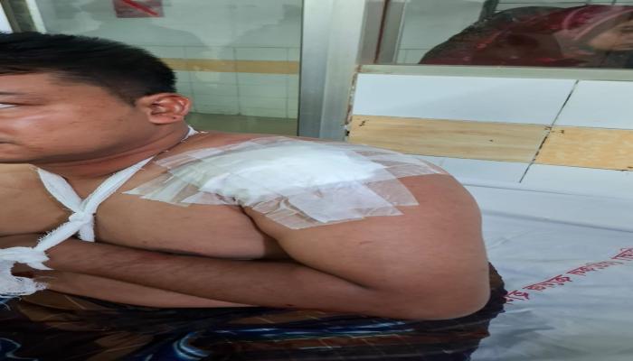 কুমিল্লার কালিরবাজারে চাঁদাবাজিতে বাধা   দেওয়ায় যুবদল নেতাকে ছুরিকাঘাত