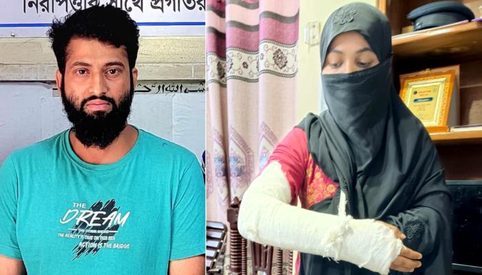 যৌতুকের টাকা না পেয়ে স্ত্রীকে পিটিয়ে হাড় ভাঙার অভিযোগে স্বামী গ্রেপ্তার